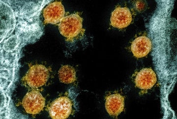 Microscopic view of viruses