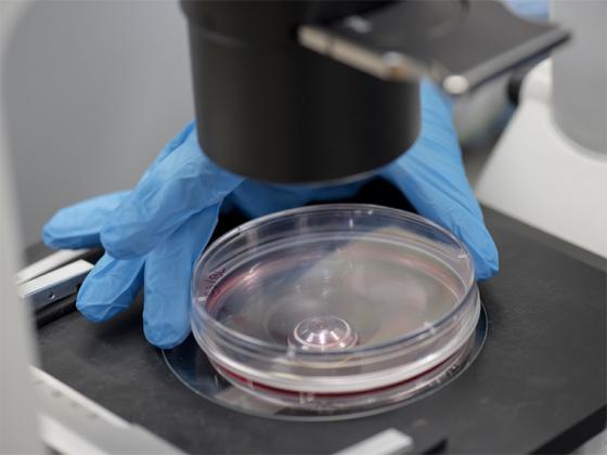 Hand placing a petri dish under a microscope.