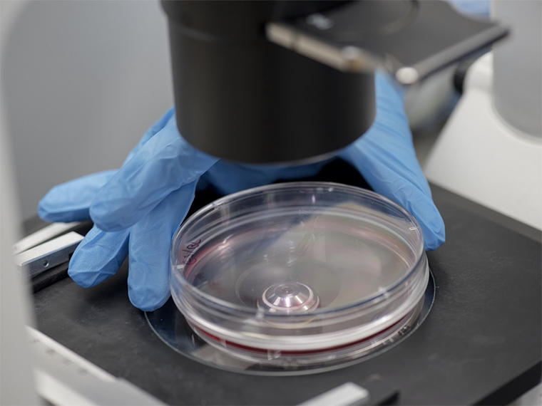 Hand placing a petri dish under a microscope.